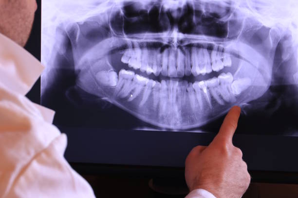 Best Emergency Gum Treatment in Girard, IL