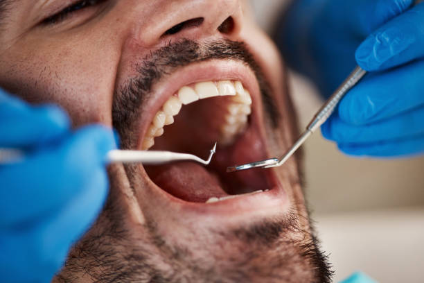 Fast & Reliable Emergency Dental Services in IL